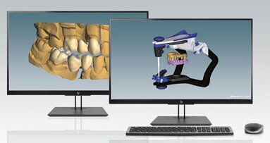 Ceramill Software-Update bietet neue Möglichkeiten für Inhouse-Fertigungsprozesse