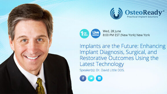 Webinar to discuss latest technology in implantology