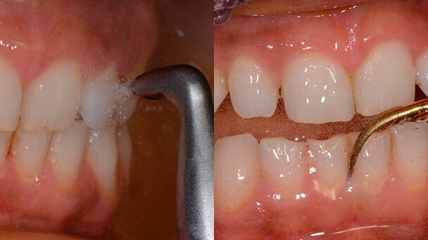L’igienista dentale? Null’altro che il “dental coach” del paziente