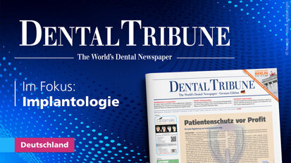 Moderne Implantologie im Fokus der aktuellen Dental Tribune Deutschland Moderne Implantologie im Fokus der aktuellen Dental Tribune Deutschland