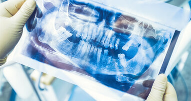 FDI: Neuer Behandlungspfad für teilbezahnte Patienten vorgelegt