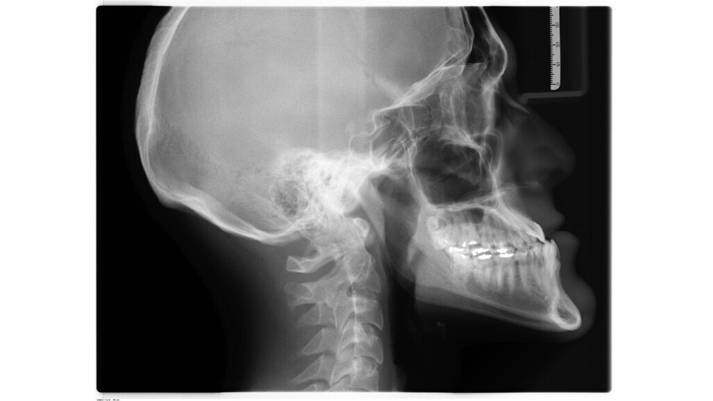 Nascholing stralingsbescherming voor hele team voor één bedrag per jaar