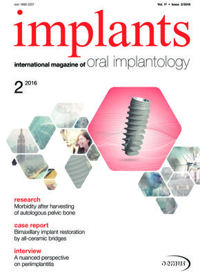implants international No. 2, 2016 implants international No. 2, 2016