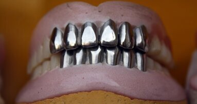 Większość Polaków ma braki zębowe i choroby przyzębia