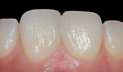 Fig. 13: After 4 days