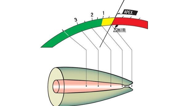 Résultats du sondage sur les localisateurs d'apex