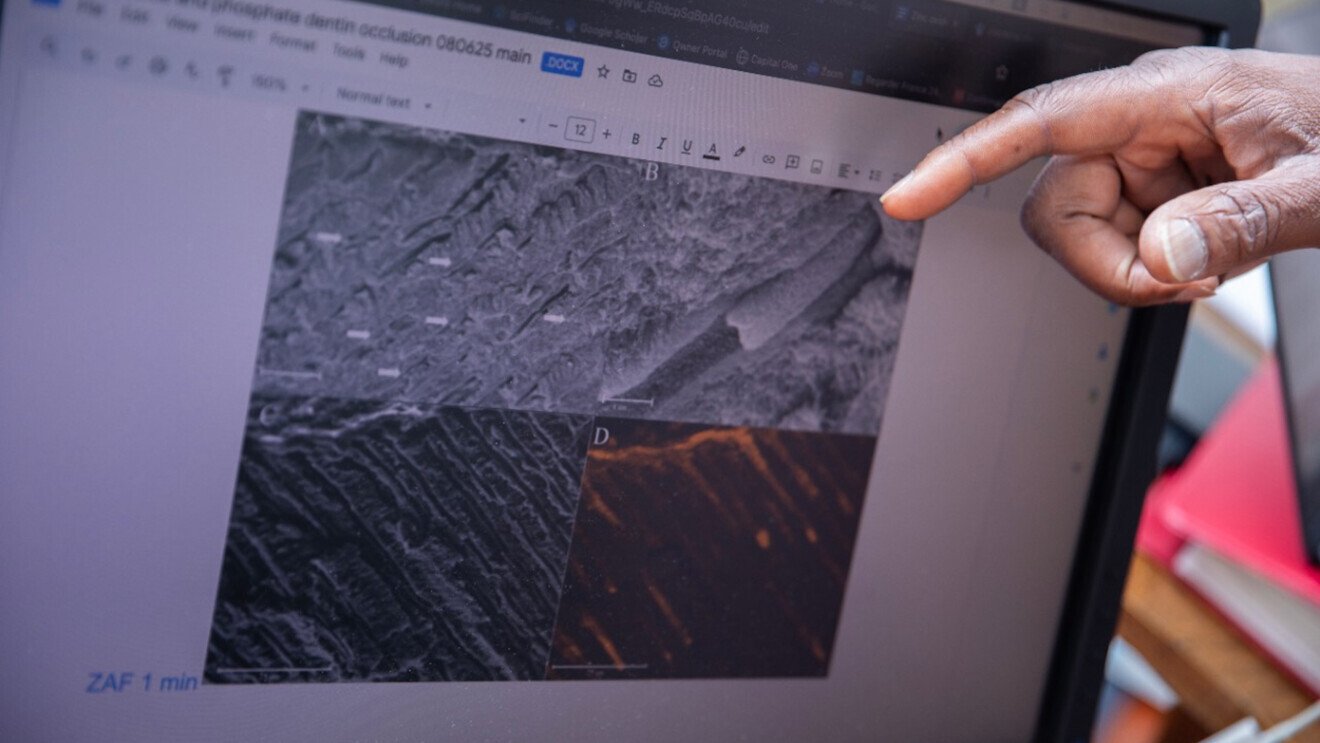 Microscopic image of a dentinal tubule filled with the zinc compound.