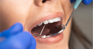 Kostenzuschüsse für Parodontitisbehandlung