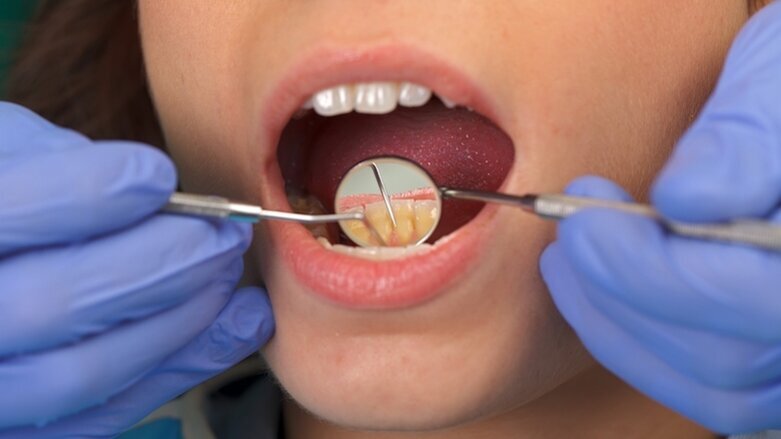 GC America to present live, biofilm-focused seminar