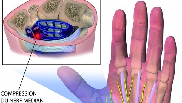 La prévention sur le bout des doigts