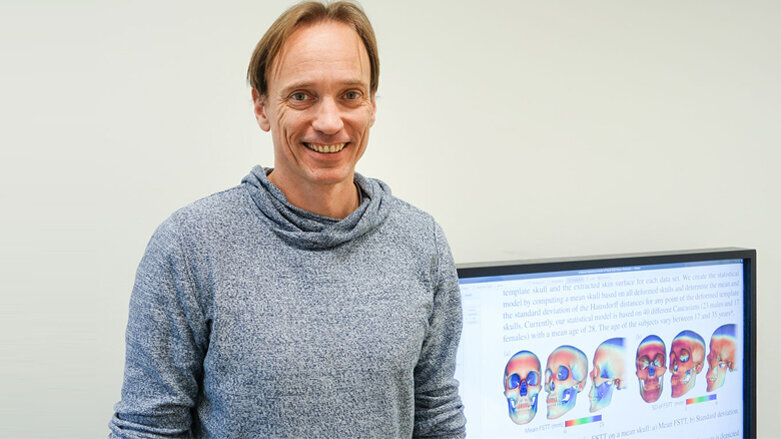 Schädelform in 3D berechnen – spart Röntgenaufnahmen