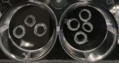 Strontium-loaded scaffold may improve dental implant wound healing Strontium-loaded scaffold may improve dental implant wound healing