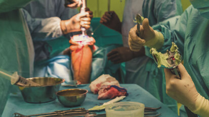 Study shows both endoprosthesis surgeons and patients need more oral health training Study shows both endoprosthesis surgeons and patients need more oral health training