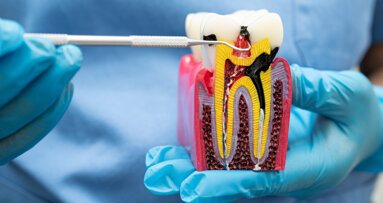 Researchers uncover gene teamwork behind tooth root formation