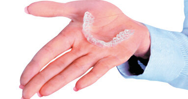 Οι διαφανείς νάρθηκες αποδεικνύονται πιο επωφελείς από τα ορθοδοντικά άγκιστρα