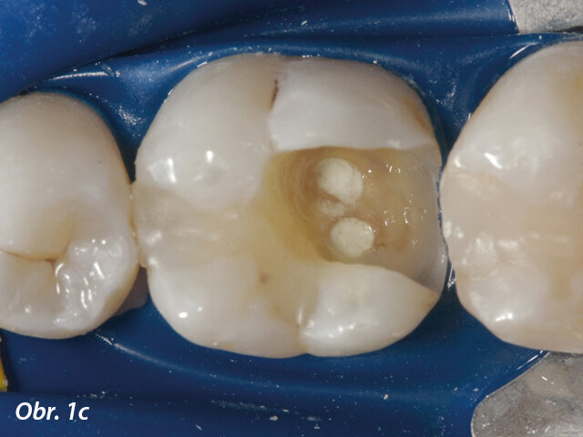 Aplikace MTA s MAP systémem a PD MTA White