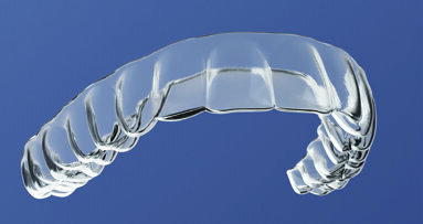 Rescue aligners are designed to get patients' aligner treatments back on track