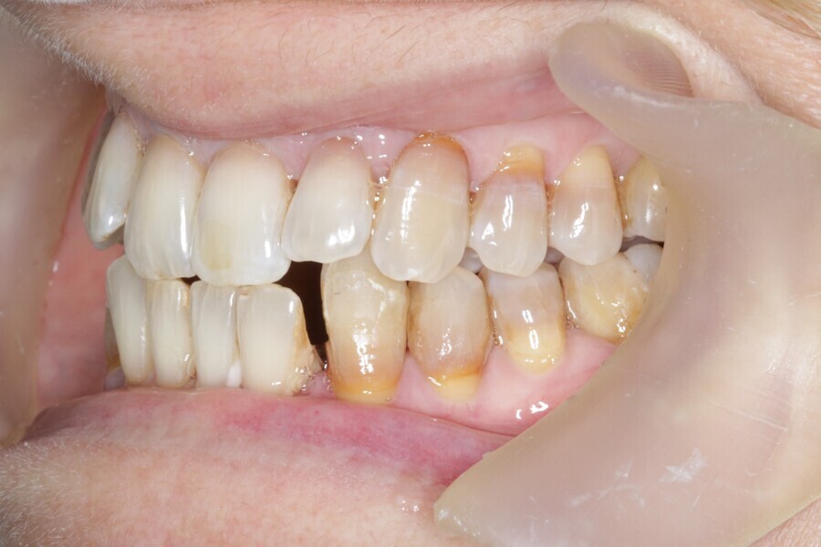 Fig. 35: Case ready to scan and submit to Reveal.