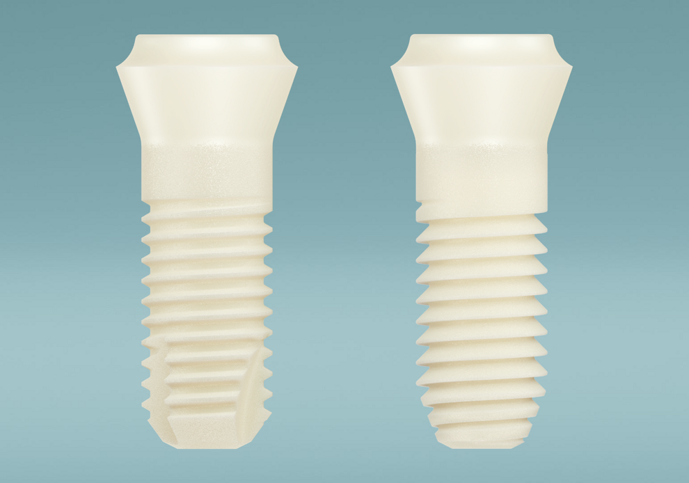 Patent Symbionic Teeth are available in two endosseous profiles: Care and Performance. The Care Profile is designed to support tissue preservation while enabling precise surgical placement. The Performance Profile is intended for more challenging cases in which greater primary stability is required.