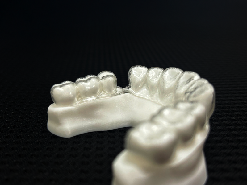 Fig. 13d: Edentulous area with snug fit of the SMA without block out.