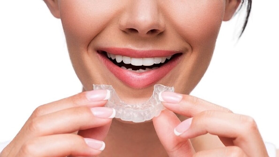 Alineadores y biocompatibilidad