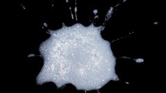 Speekselonderzoek bij ACTA: van fundamentele biochemie naar klinische toepassingen