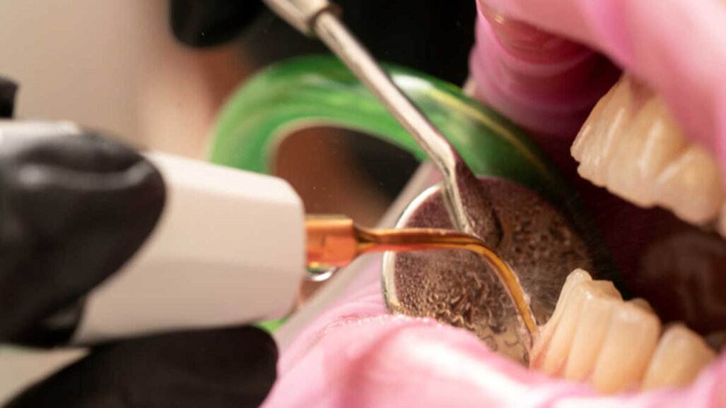 Um higienista dental híbrido