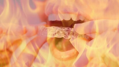 ¡Cuidado con los tratamientos dentales que se publicitan en redes!