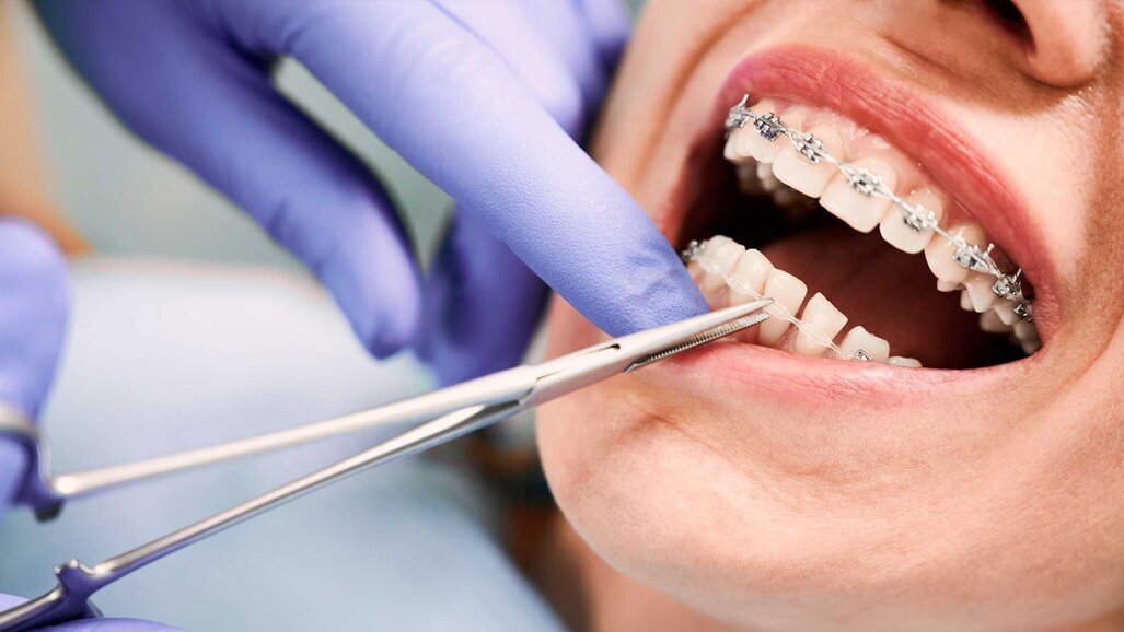 Startschuss für die Facharztausbildung für Kieferorthopädie