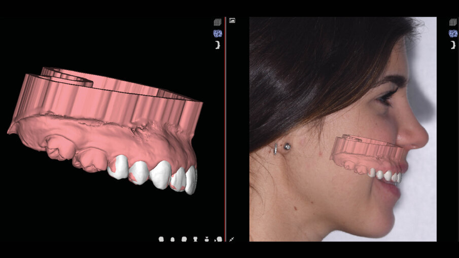 Figg. 5a-6b_Valutazione iniziale.