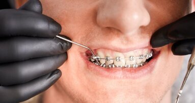 Prawidłowy zgryz to warunek utrzymania równowagi funkcjonalnej całego organizmu