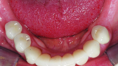 Komplicirane rekonstrukcije mijenjaju život pacijenta