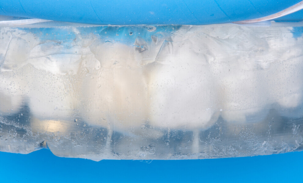 Fig. 19 : Injection à travers le puit de la clef transparente et photopolymérisation.