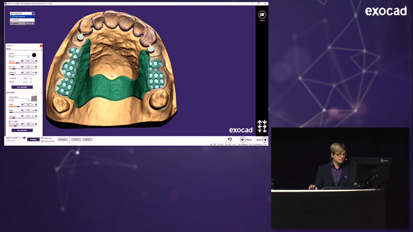 exocad – INSIGHTS 2018: PartialCAD Software Session by Friedemann Stang