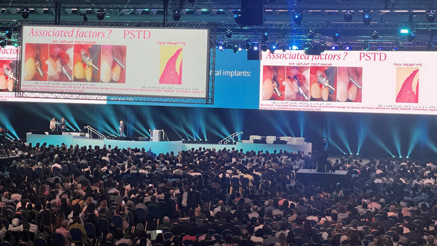 With 5,700 implantologists from around the world, the ITI World Symposium 2024 in Singapore is the largest dental implant meeting this year. (All images: Dental Tribune International)