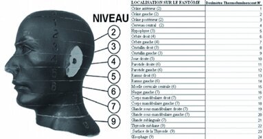 Cone beam pratique en odontostomatologie – Partie II - Principe, technique, qualité d’image, artéfacts, types d’appareil, indications