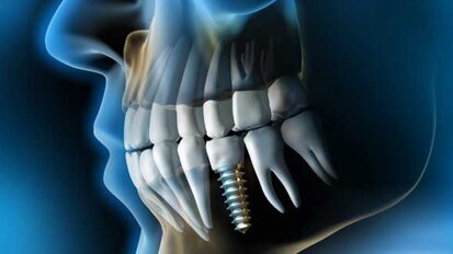 ITI-Kongress 2013 in Salzburg