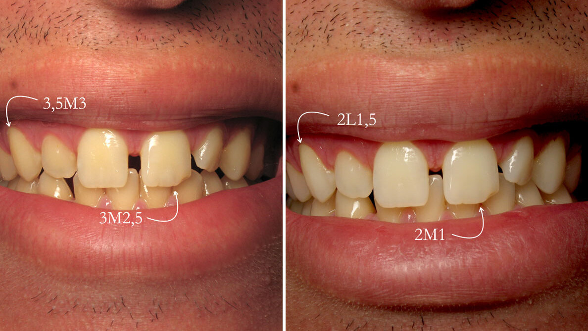 50 sombras de blanco