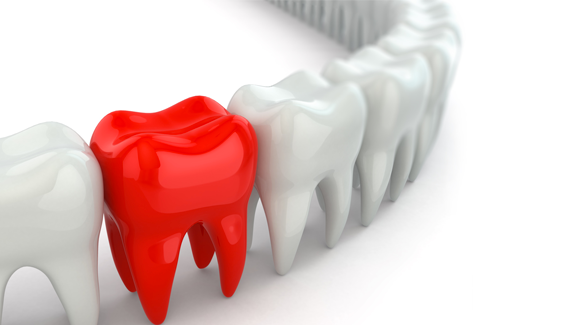 Amis vs. Briten – wer hat bessere Zähne?