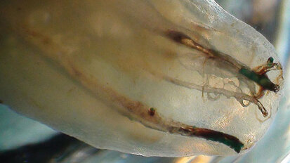 Interview: 'The immense variability of human tooth anatomy'