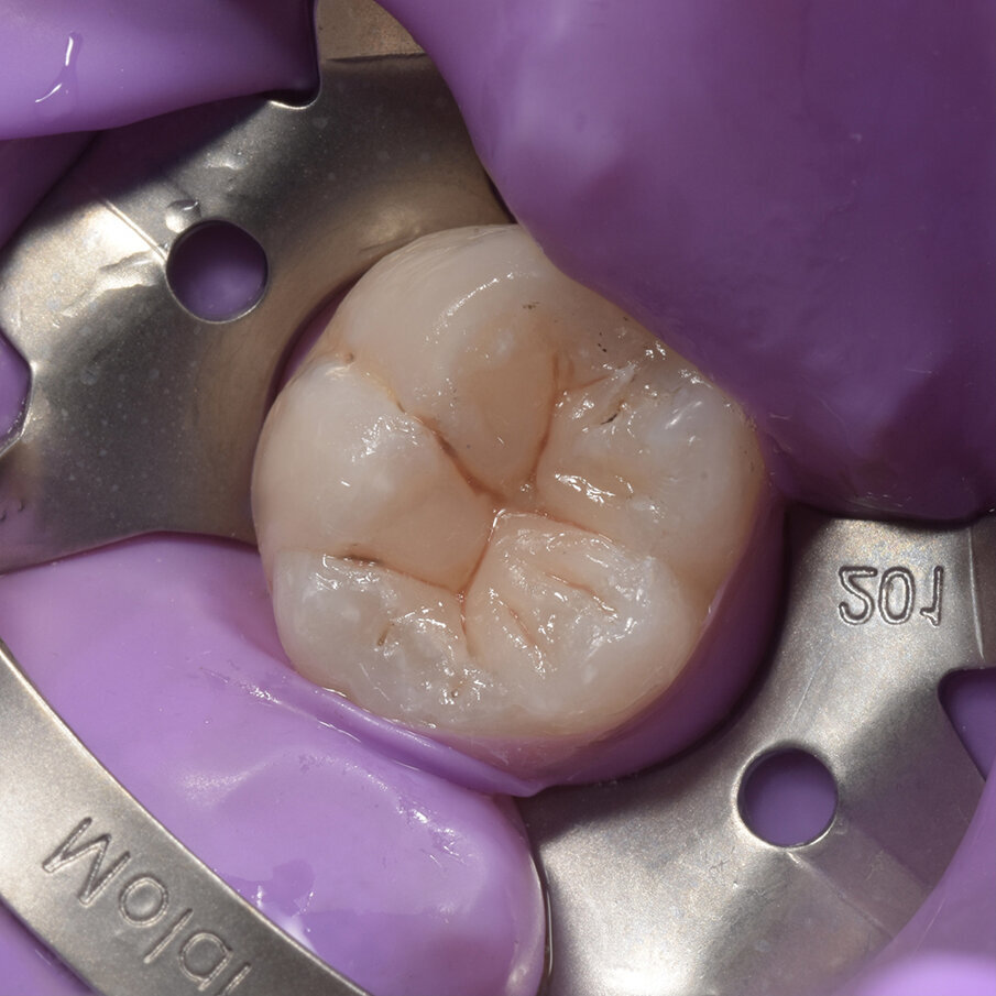 Fig 9: Create the groves with LM Arte Fissura & Dark Brown stain 