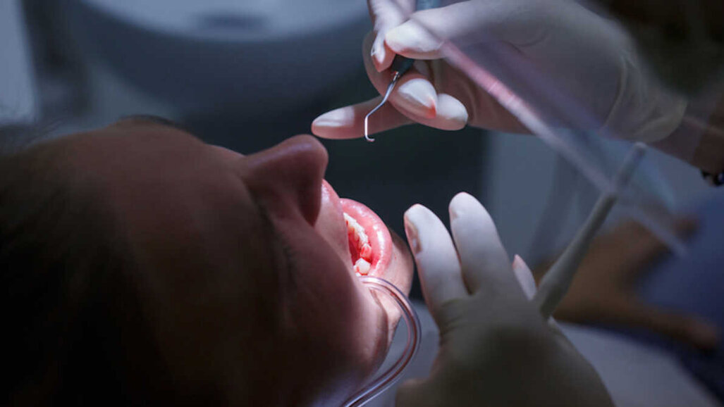 Пародонталният статус може потенциално да влияе на тежестта на протичане на COVID-19