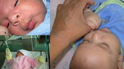 La importancia del desarrollo psicomotor del lactante