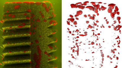 Laserverfahren ermöglicht Bakterien-Scan auf Implantaten