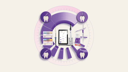 FKG Dentaire launches 4D Workflow for streamlined endodontics