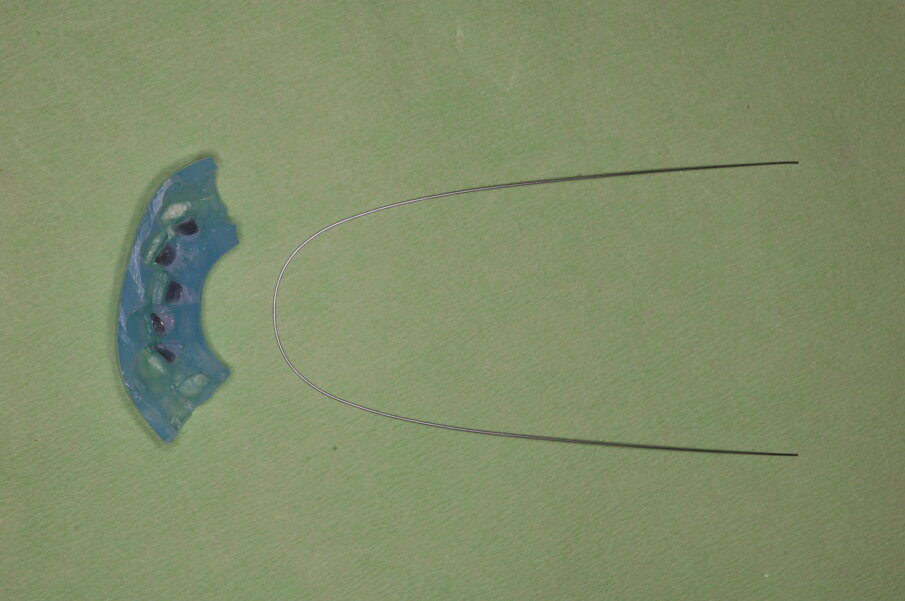 Fig. 30_Tray per l’incollaggio indiretto e filo in nichel-titanio da 0,014 pollici. 