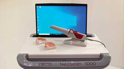 Neoss Group reveals its brand new, easy-to-use intraoral scanner.