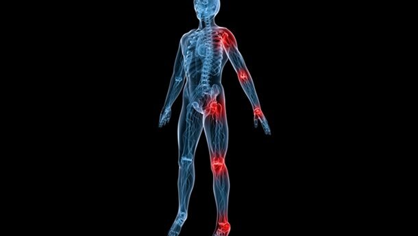 Mundhygiene bei Rheumatikern besonders wichtig