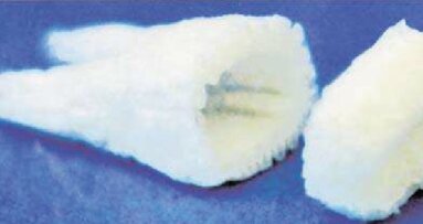 Το  πανεπιστήμιο Columbia ανακοινώνει καινοτομίες στην οδοντική ανάπλαση. Σκελετός από βλαστοκύτταρα μπορεί δυνητικά να αντικαταστήσει τα οδοντικά εμφυτεύματα