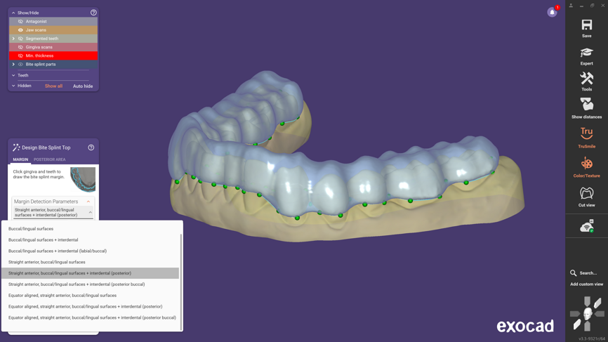 Improved occlusal splint design.